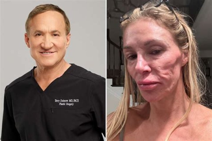 Ace Dubrow Before And After Photos: Did He Have Surgery?