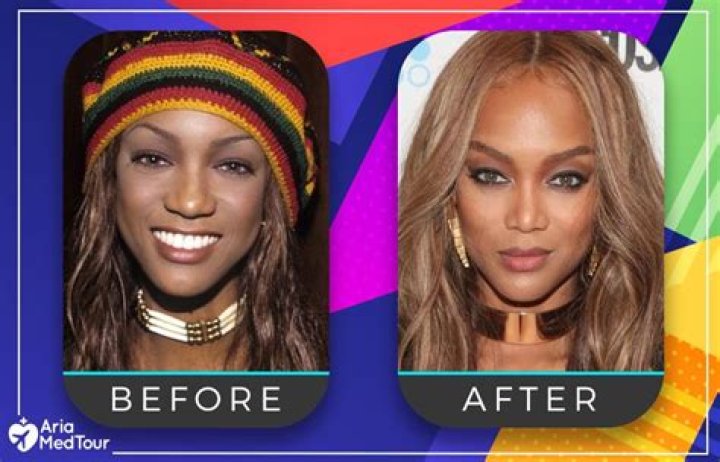 Becky G Nose Job: Before And After Photos 2023