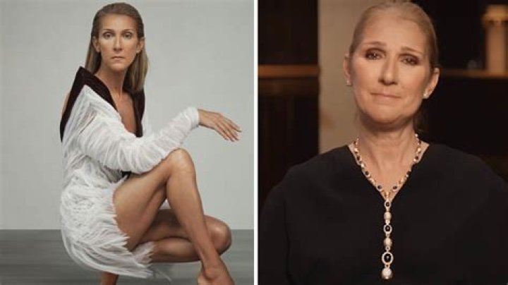 Gillian Anderson Illness And Health Update 2023: What Happened To Her? Neurofibromatosis