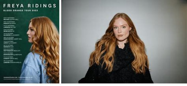 Is Freya Ridings Deaf? Health Update 2023
