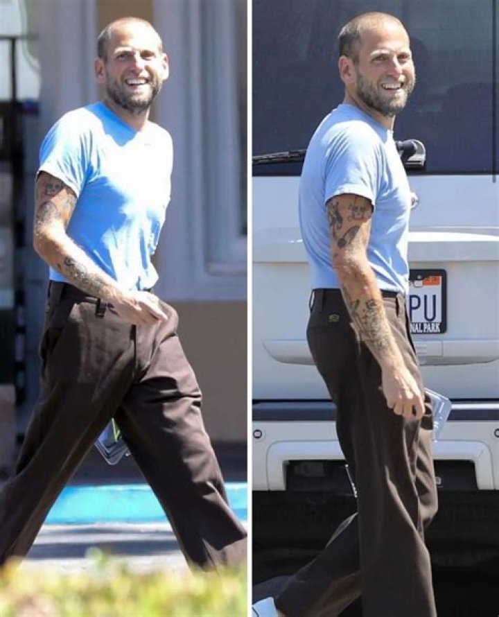 Jonah Hill Botox And Nose Job: Before And After Photos