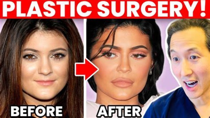 Kit Hoover Plastic Surgery: Before And After Photos