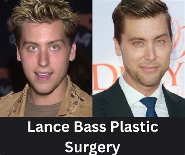 Lance Bass Plastic Surgery: Before And After Photos