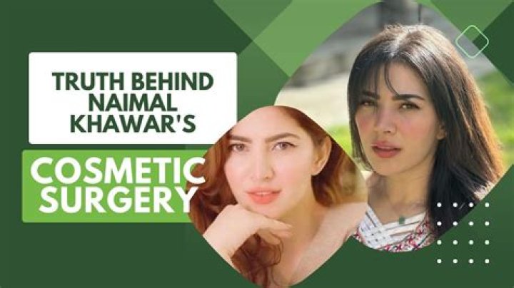 Naimal Khawar Khan Nose Job Lip Filler And Botox Amid Plastic Surgery Rumors