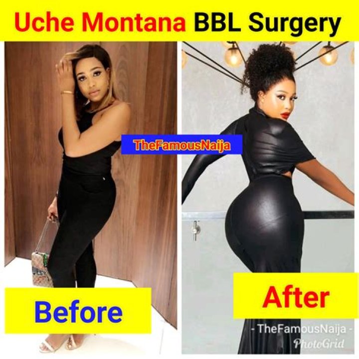Nons Miraj Before Surgery: Did She Get A BBL?