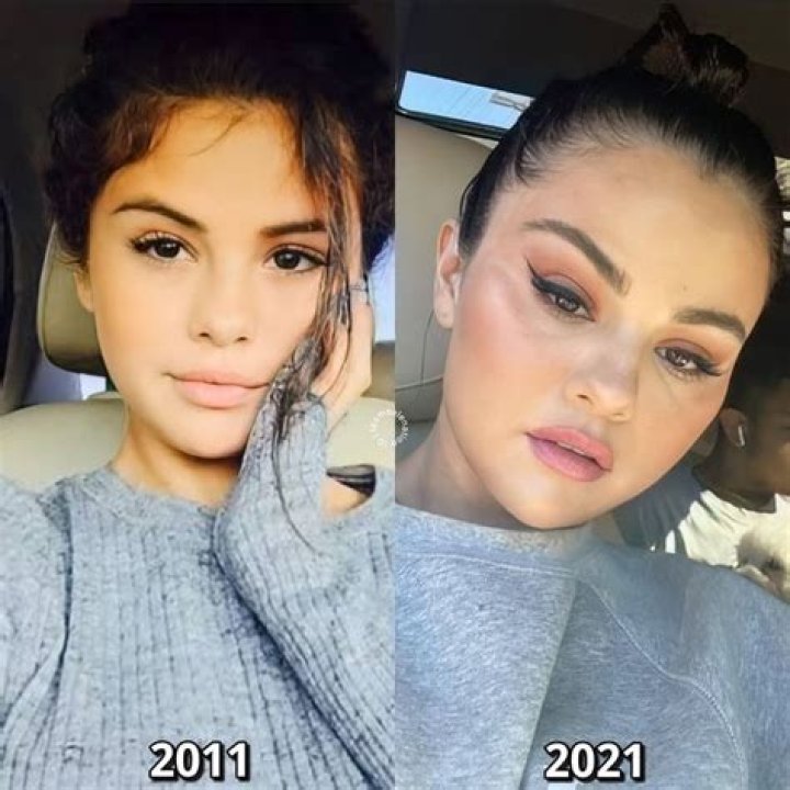 Xochitl Gomez Before And After: Did She Get Plastic Surgery?